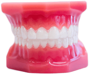 clear aligners on model